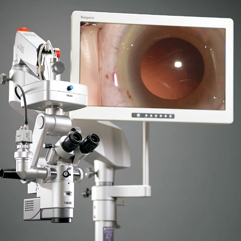 معدات طب العيون – شركة الرؤية الطبية الحديثة