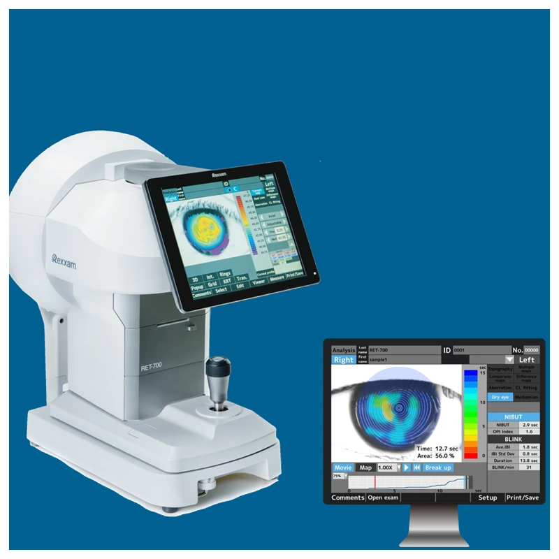 معدات طب العيون – شركة الرؤية الطبية الحديثة